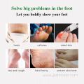 Foot Peel Mask Peeling Away Calluses